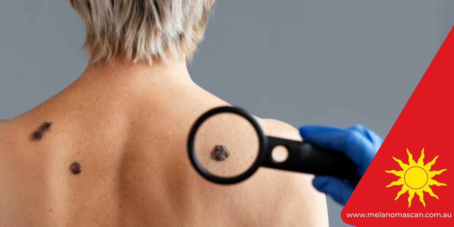 Tommy John surgery Symptoms: Early Signs Pitchers Should Never Ignore